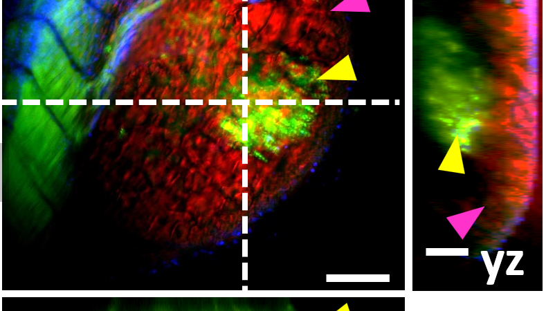 Bioimaging: Is it possible to improve the performance of microscopes?