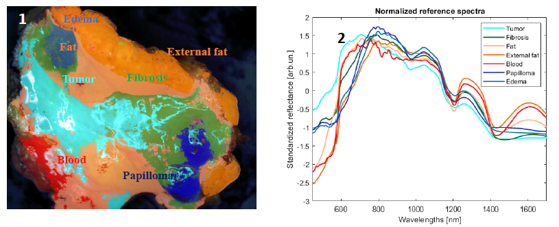 Fig.1: SAM classification based on the endmembers of fig.2.
Fig.2: SNV-corrected spectra of the light reflected by the sample. Each spectrum refers to one of the regions identified by the pathologist as indicated in fig.1.